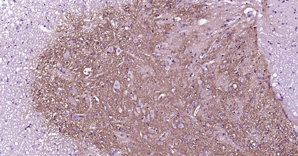 γ氨基丁酸运载蛋白1重组兔单抗
