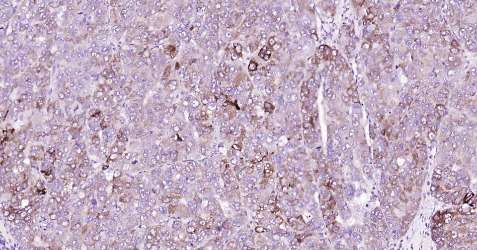 γ氨基丁酸转氨酶重组兔单抗