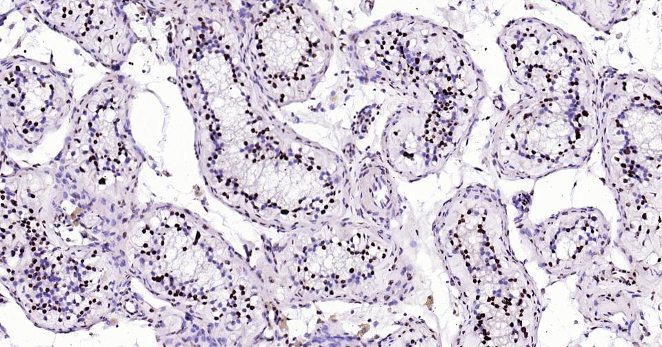 组蛋白H3（核内参）抗体-bs-0349R