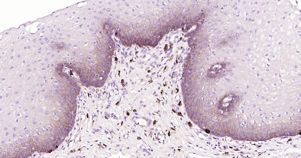 CD44抗体重组兔单抗