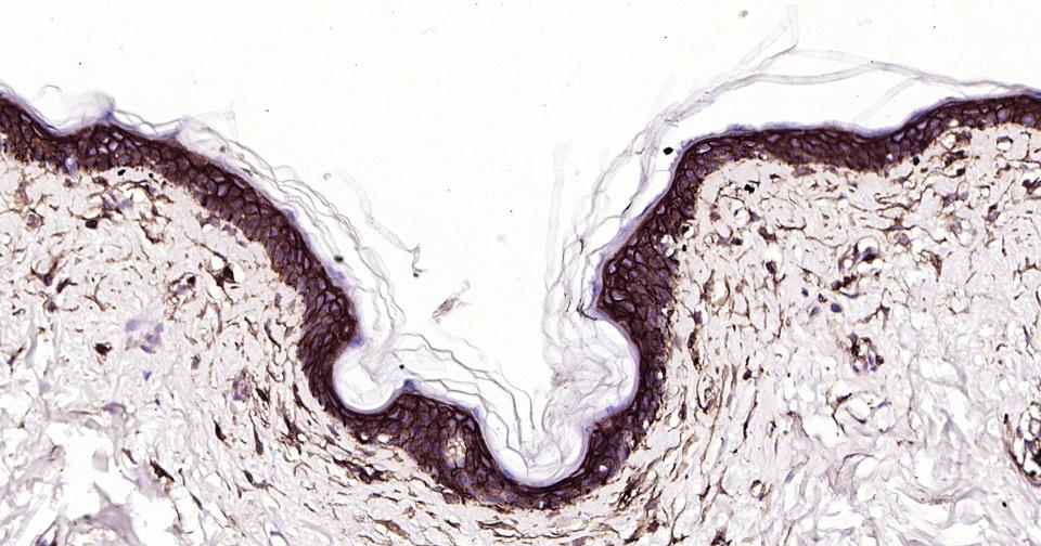 CD44抗体重组兔单抗
