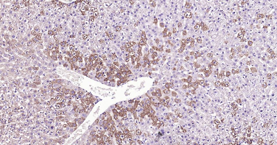 γ氨基丁酸转氨酶重组兔单抗