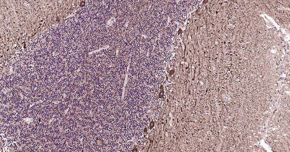 高分子量神经丝蛋白抗体