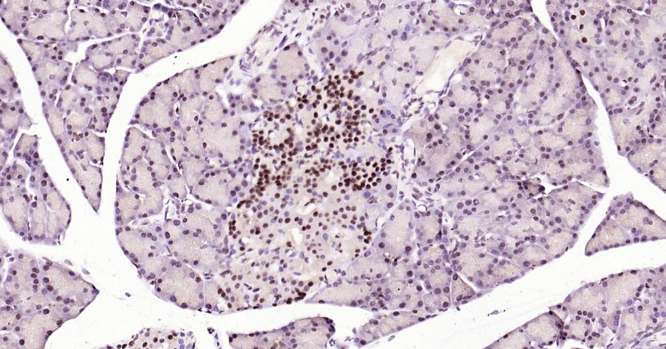 胰岛素基因增强结合蛋白1重组兔单抗