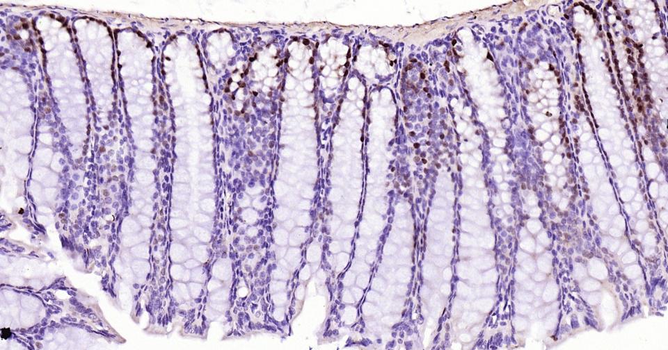 转录因子SOX9蛋白重组兔单抗