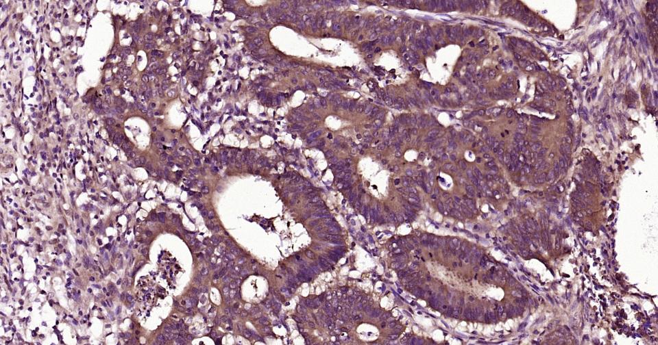 细胞核转录因子X盒结合蛋白重组兔单抗