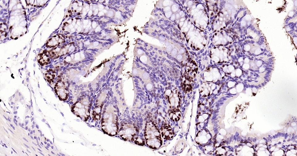 转录因子SOX9蛋白重组兔单抗
