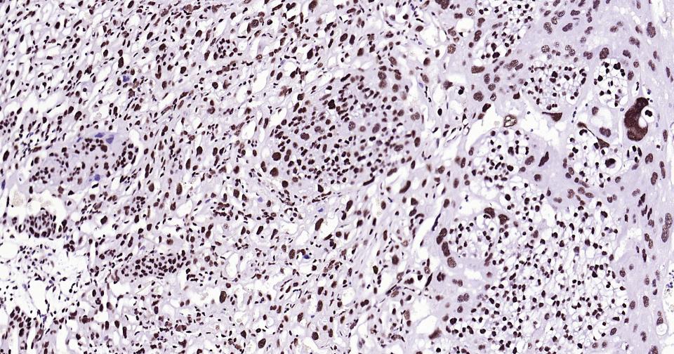 抑癌基因SNF2β重组兔单抗