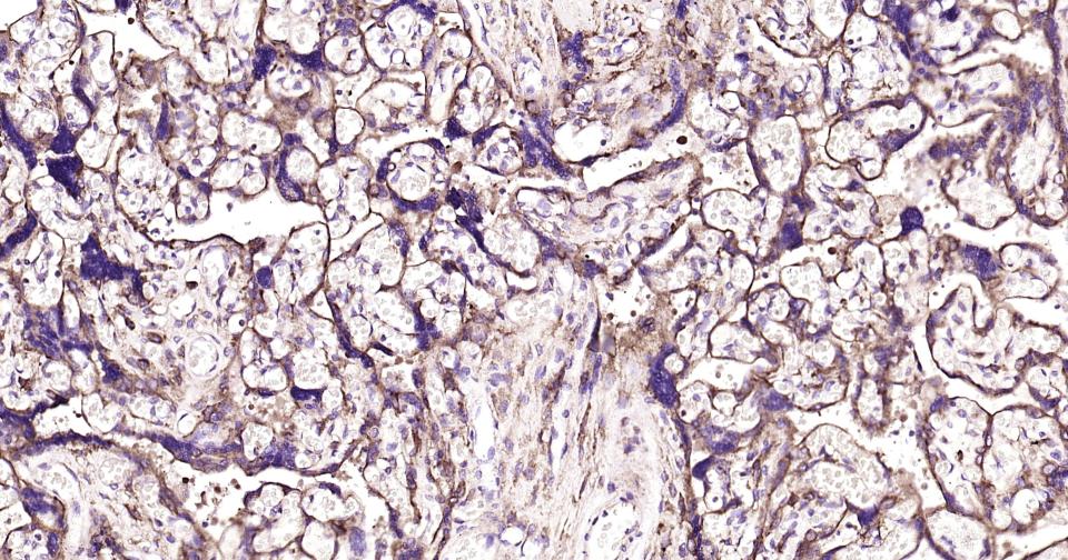 三磷酸腺苷结合转运蛋白G超家族成员2重组兔单抗