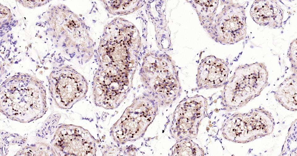 转录因子SOX9蛋白重组兔单抗