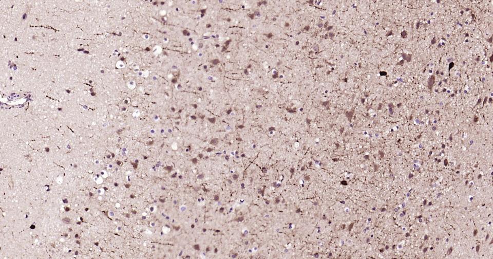细小清蛋白重组兔单抗-bsm-61405R