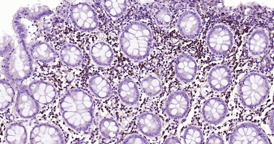 CD44抗体重组兔单抗