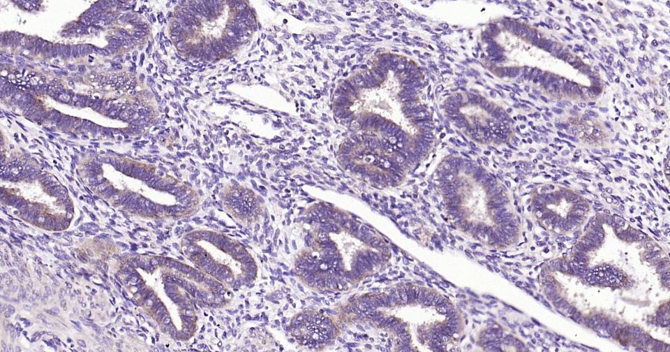 三磷酸腺苷结合转运蛋白G超家族成员2重组兔单抗