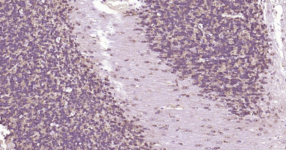 微管蛋白β1（内参）重组兔单抗