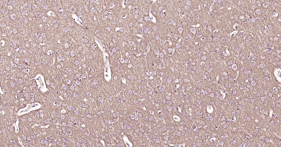 γ氨基丁酸运载蛋白1重组兔单抗
