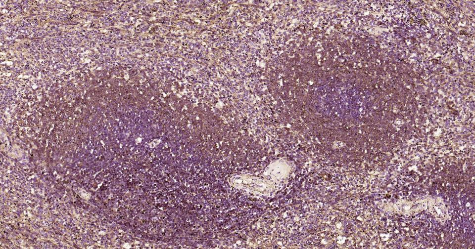 细胞核转录因子X盒结合蛋白重组兔单抗