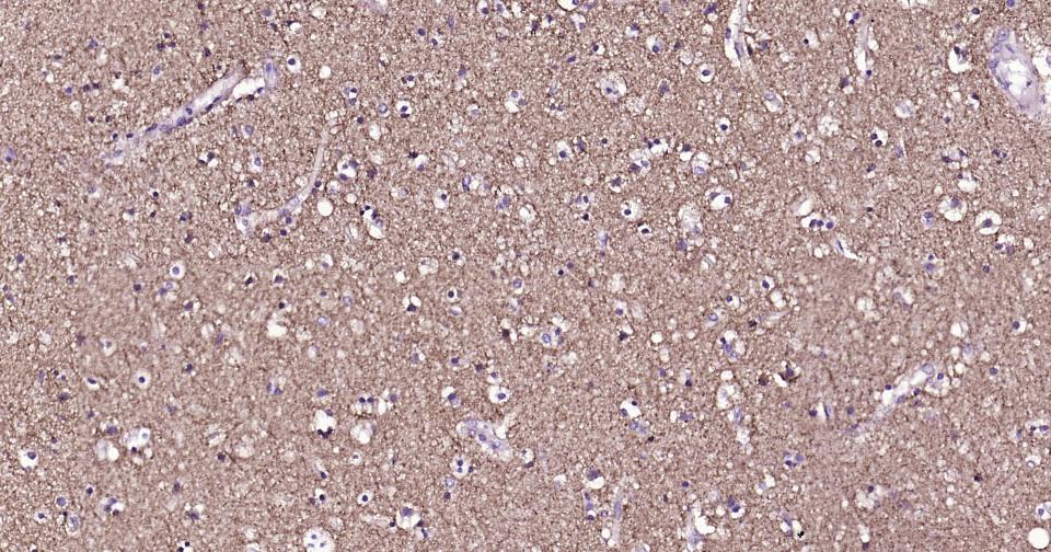 γ氨基丁酸运载蛋白1重组兔单抗