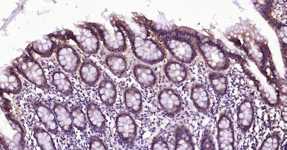 上皮钙粘附分子重组兔单克隆抗体