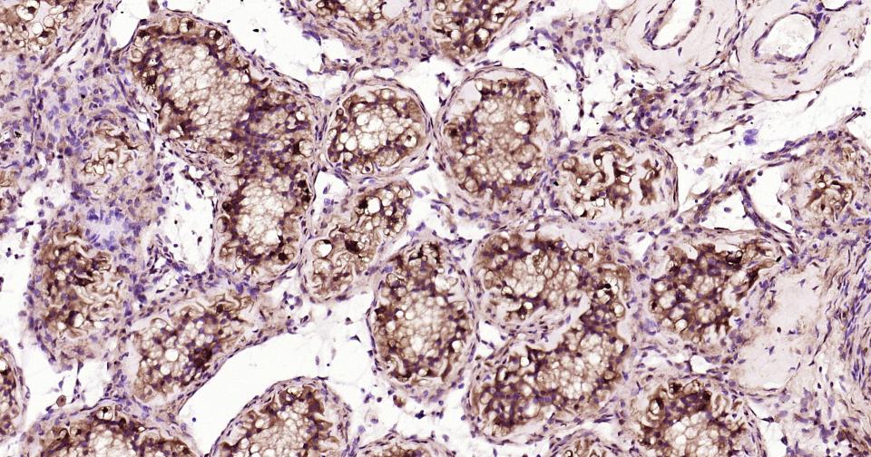 细胞核转录因子X盒结合蛋白重组兔单抗