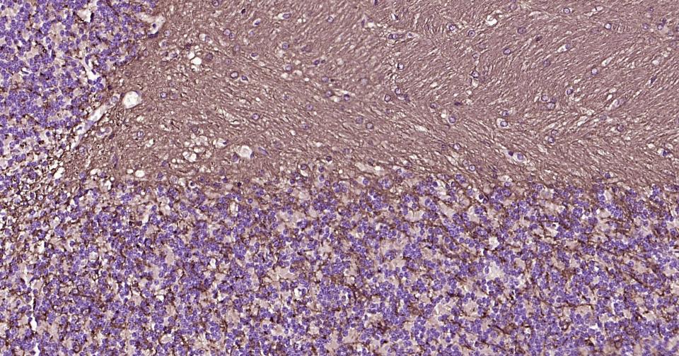 2’,3’-环腺苷酸-3’-磷酸二酯酶重组兔单抗-bsm-61411R