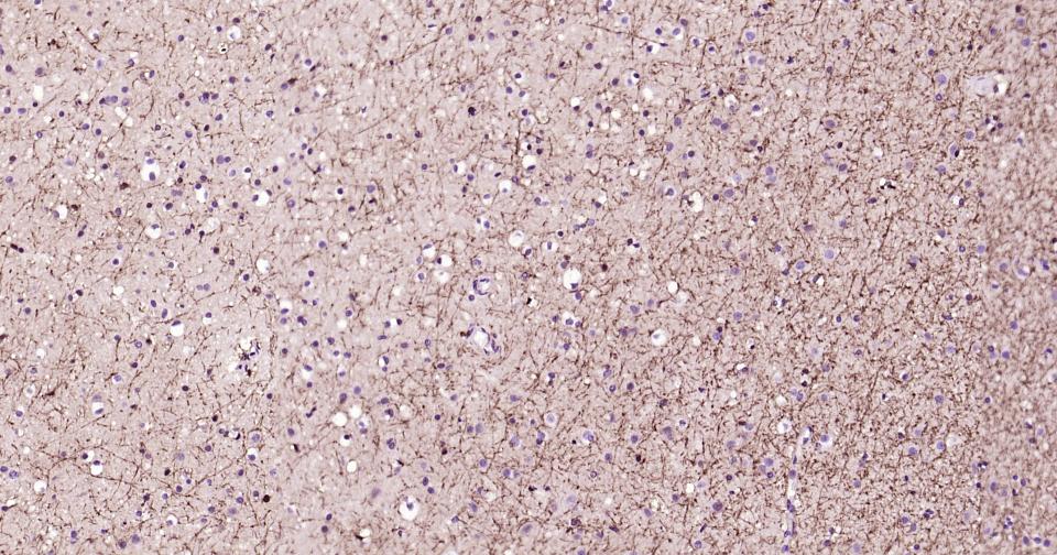 2’,3’-环腺苷酸-3’-磷酸二酯酶重组兔单抗-bsm-61411R