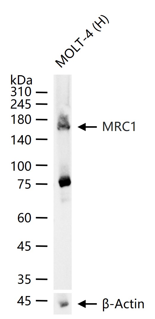 巨噬细胞甘露糖受体 (CD206) 抗体