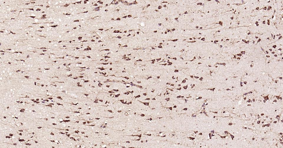 钙网蛋白抗体-bs-5913R