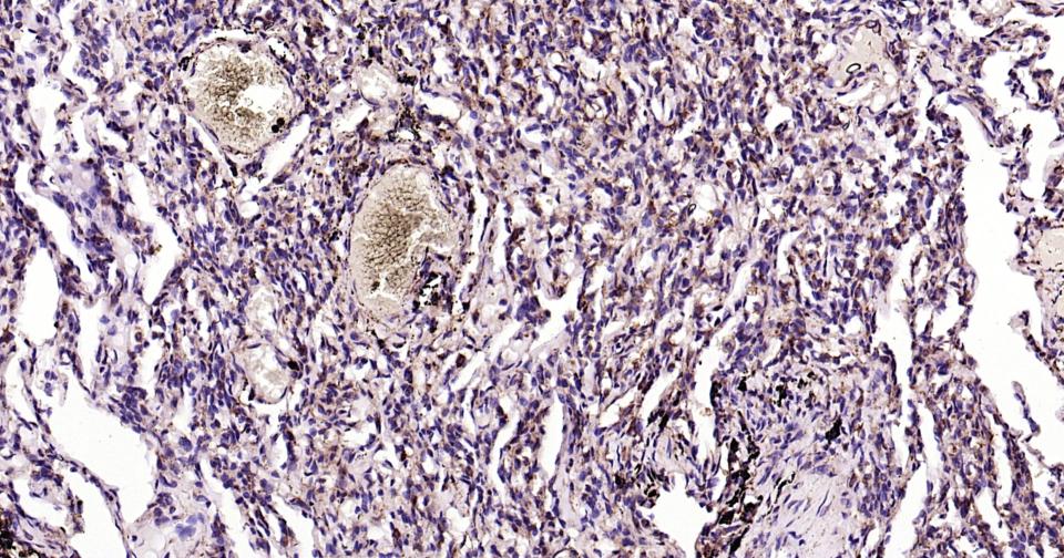 钙网蛋白抗体-bs-5913R