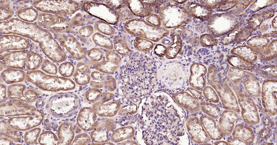 钙网蛋白抗体-bs-5913R