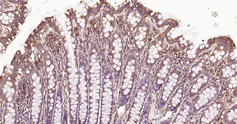 钙网蛋白抗体-bs-5913R