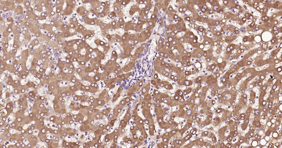 钙网蛋白抗体-bs-5913R