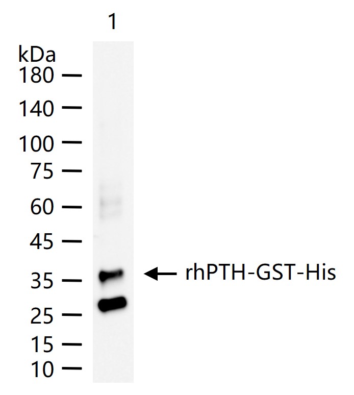 甲状旁腺激素重组兔单抗