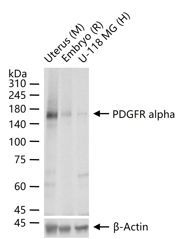 PDGFRα重组兔单抗