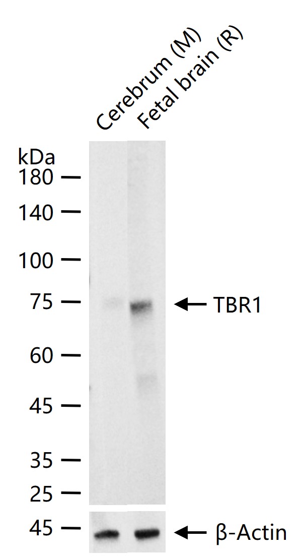 TBR1蛋白重组兔单抗