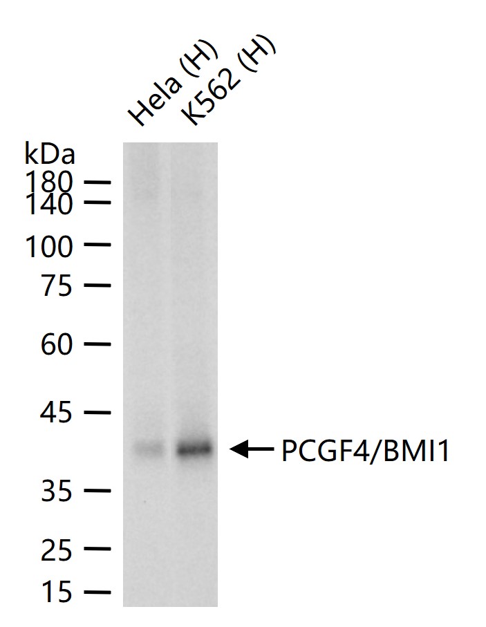 PCGF4/BMI1 Recombinant Rabbit mAb (一抗) | Bioss