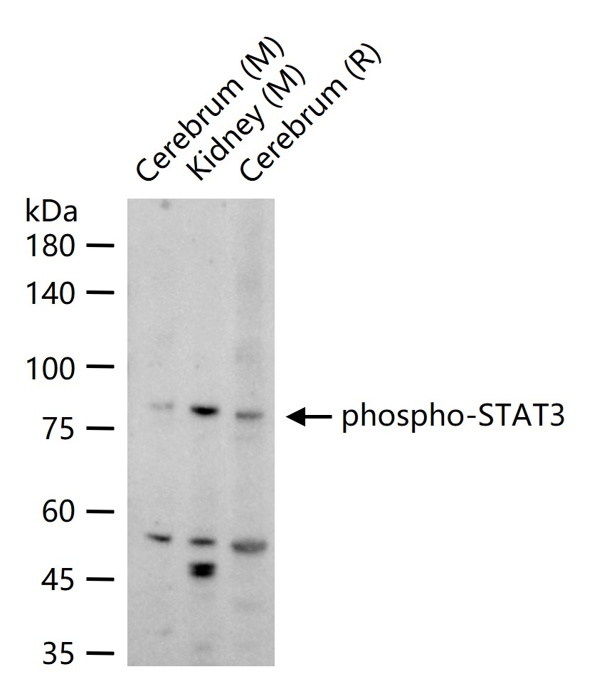 phospho-STAT3 (Tyr705) Rabbit pAb (一抗) - WB | Bioss