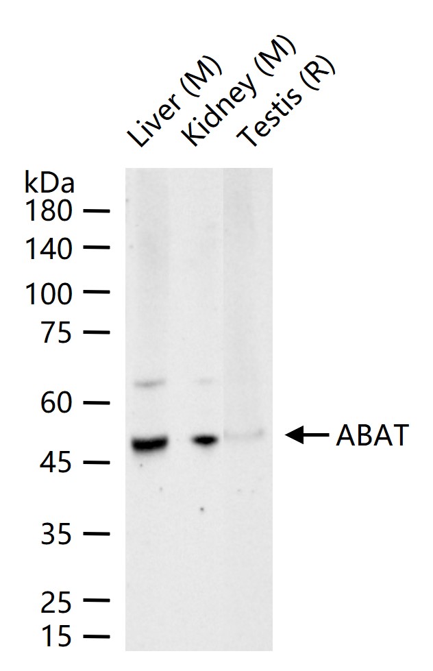 γ氨基丁酸转氨酶重组兔单抗