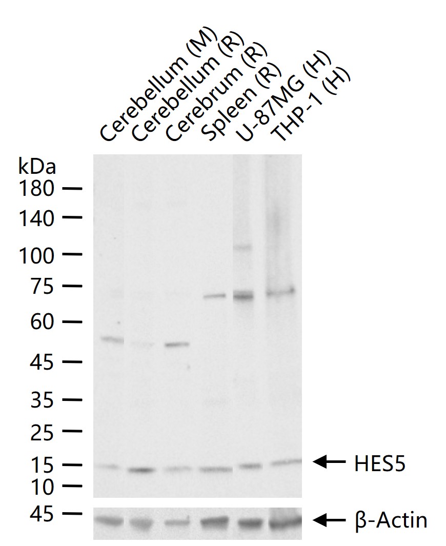 发状分裂相关增强子-5重组兔单抗