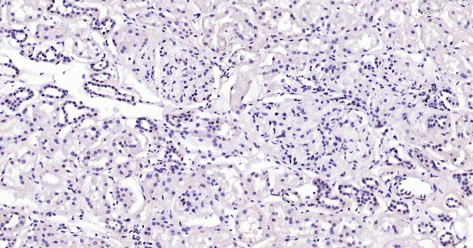 磷酸化信号转导和转录激活因子3重组兔单抗