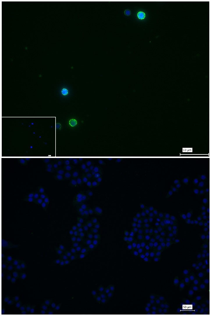 CD79b重组兔单抗