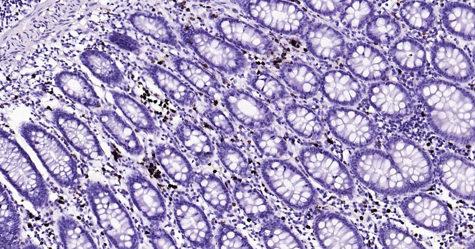 颗粒酶B单克隆抗体-bsm-34135M