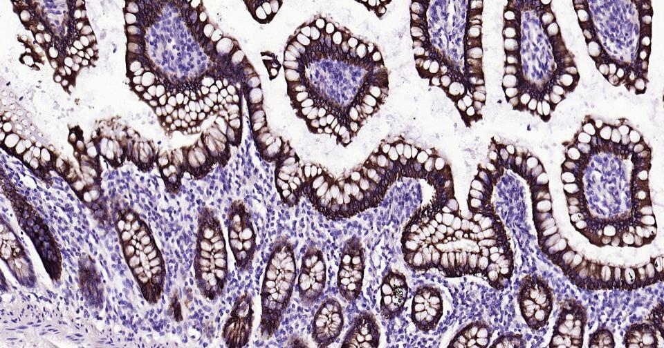 细胞角蛋白20重组兔单抗