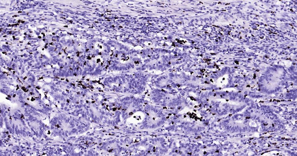 颗粒酶B单克隆抗体-bsm-34135M