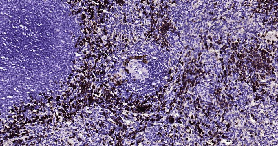 颗粒酶B单克隆抗体-bsm-34135M