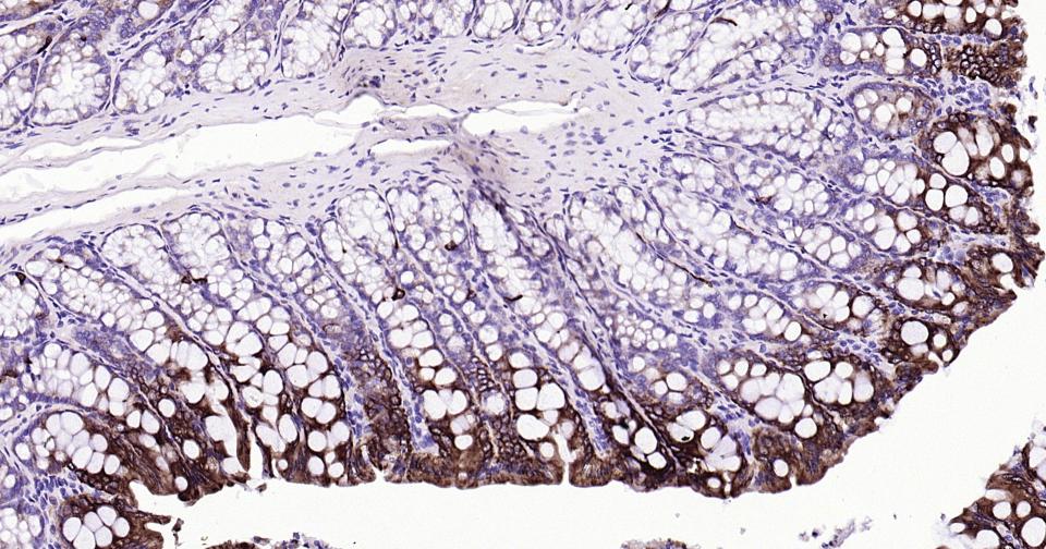 细胞角蛋白20重组兔单抗