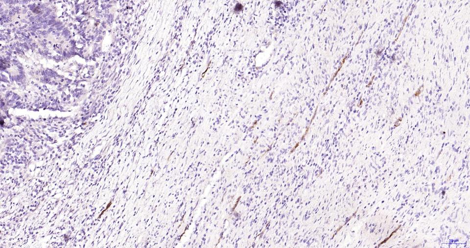P选择素/白细胞内皮细胞粘附分子3重组兔单抗