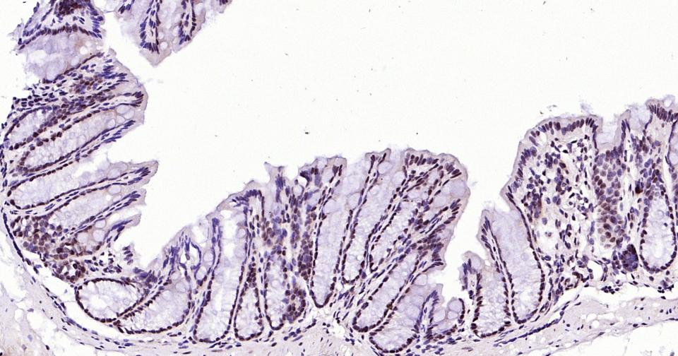 磷酸化信号转导和转录激活因子3重组兔单抗