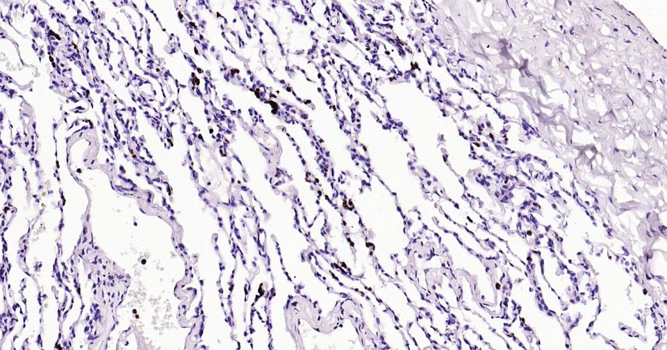 颗粒酶B单克隆抗体-bsm-34135M