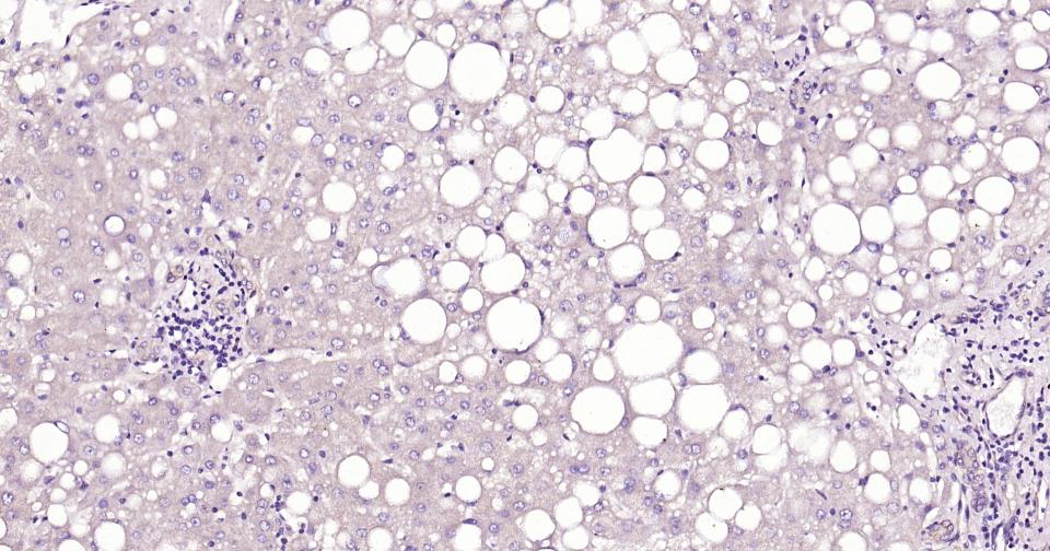 细胞角蛋白20重组兔单抗