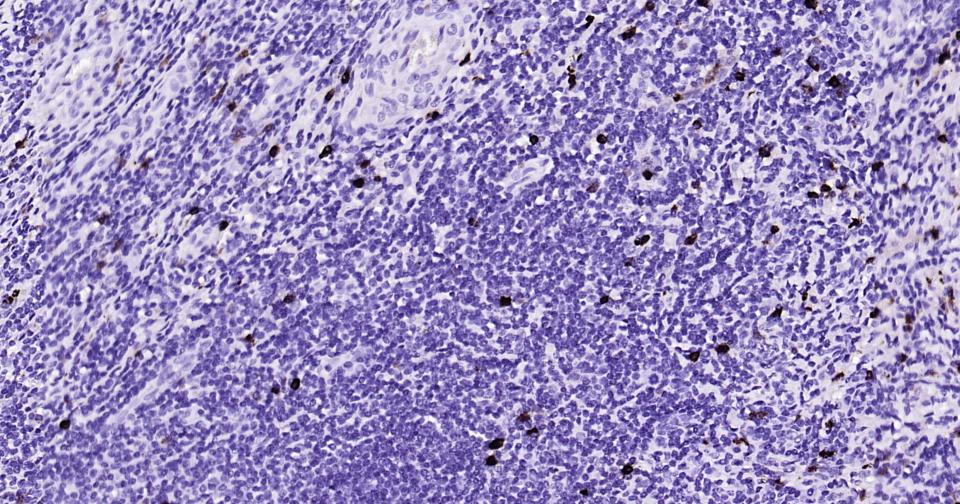 颗粒酶B单克隆抗体-bsm-34135M